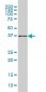 AKR1B10 Antibody (clone 1A6)